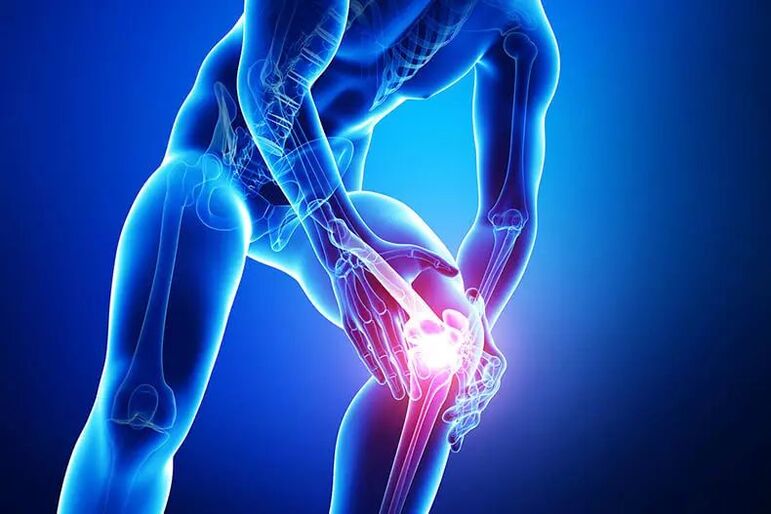 Symptômes de l'arthrose